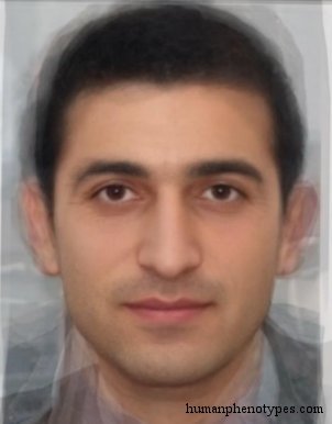 Armenid
