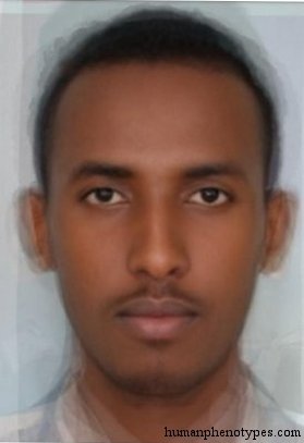 East Ethiopid