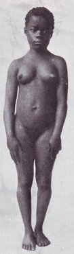 Trunk length
