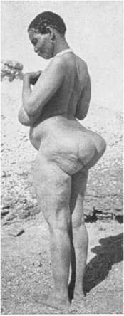 Steatopygia