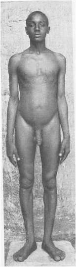 Body hair