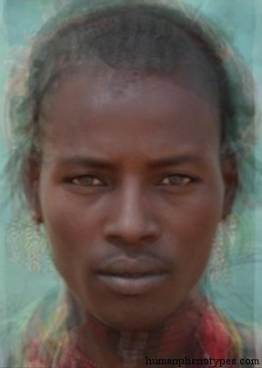 Omotic