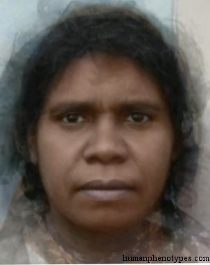 South Australid — ♀ female