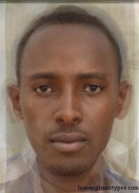 South Ethiopid