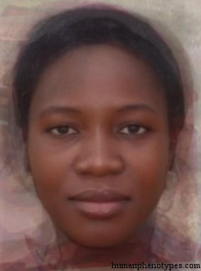Sudanid (proper) — ♀ female